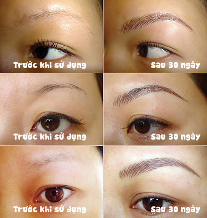 Hiệu quả sau một thời gian khi sử dụng RevitaBrow EyeBrow